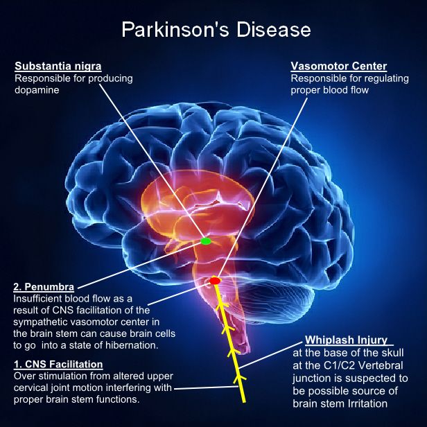10 best Parkinson