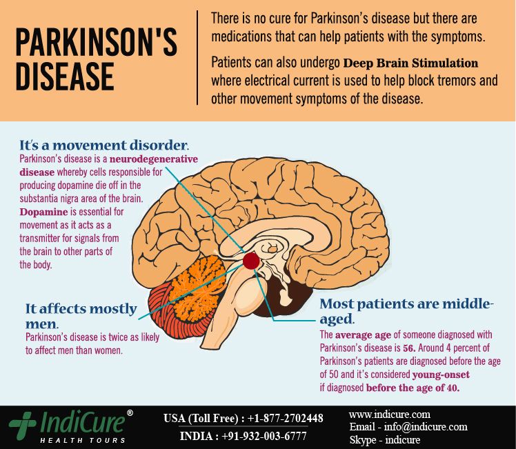 Deep brain stimulation in parkinson