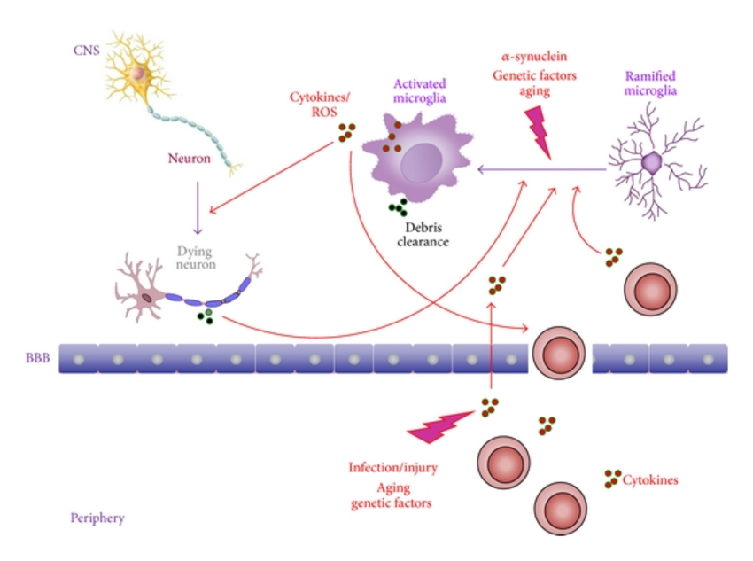 Inflammatory pathways in Parkinsons disease. An acute ...