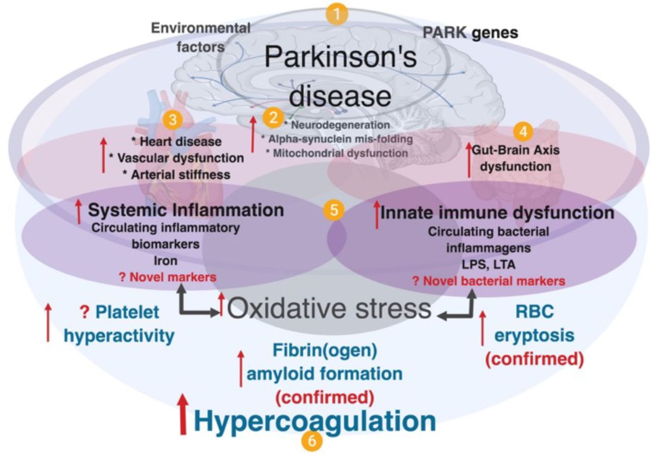 Parkinsons disease: a systemic inflammatory disease ...