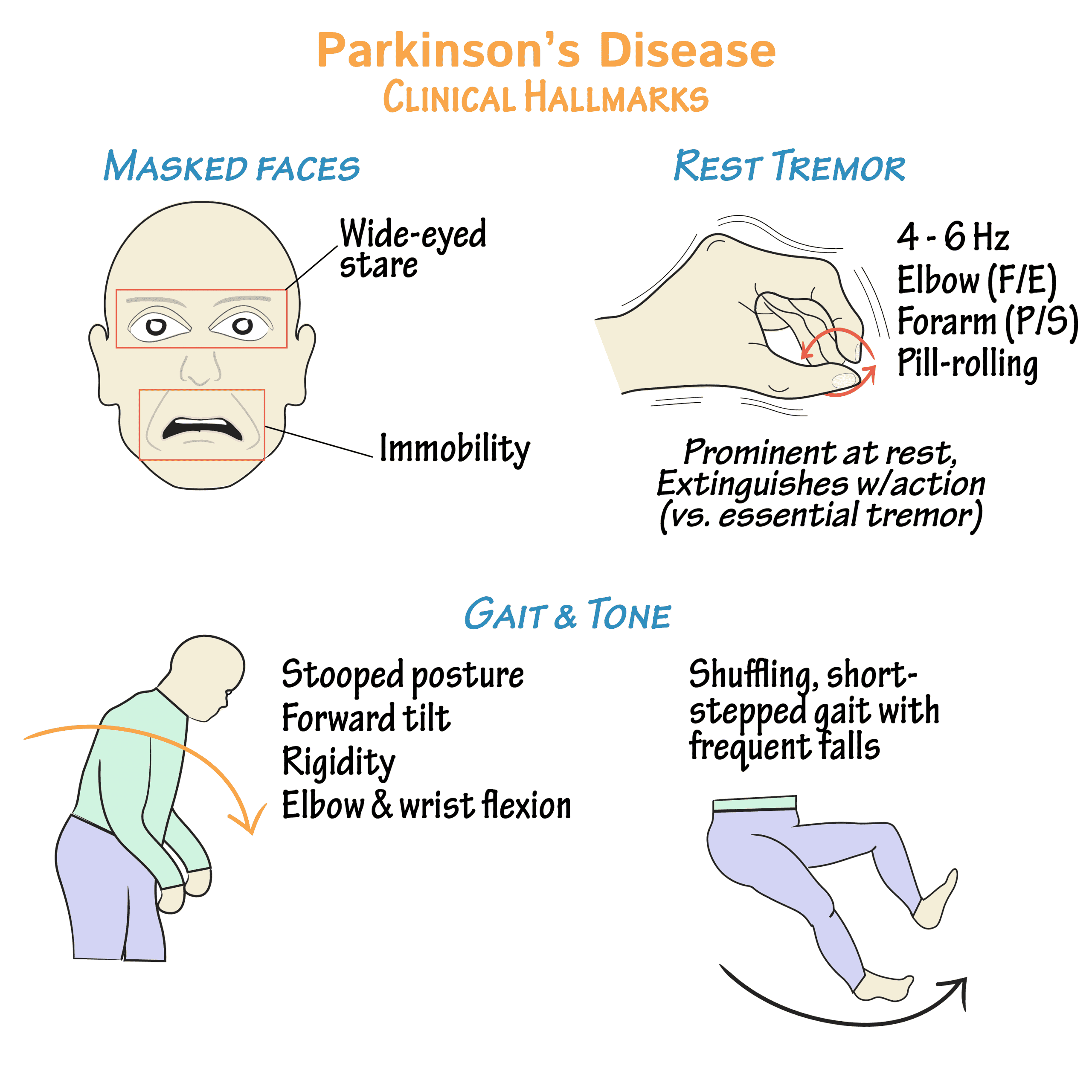 50+ Essential Tremor Vs Parkinsons