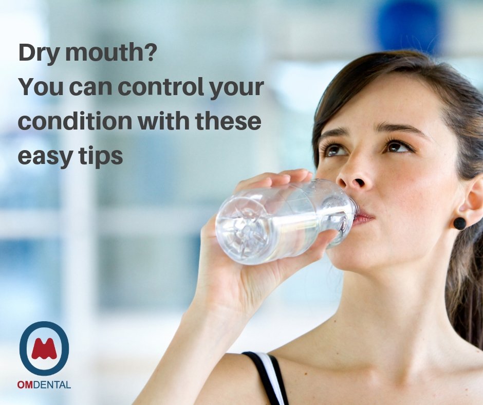 Basic Tips for controlling Dry Mouth