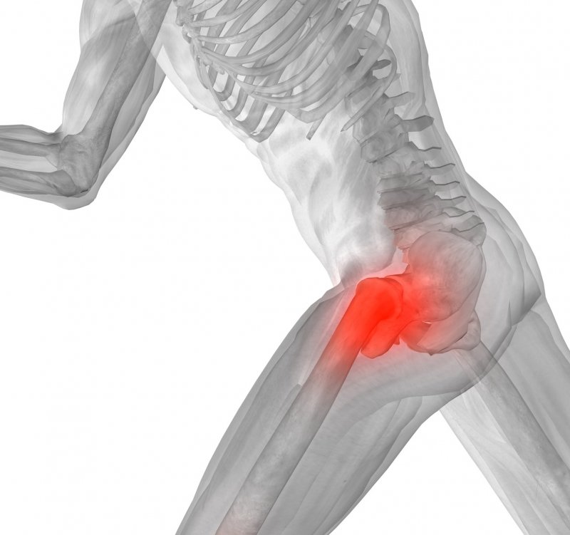 Best Physiotherapy for Hip Pain in Gurgaon