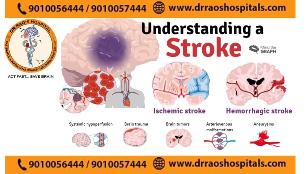 Best Stroke and Cerebrovascular Treatment in Andhra Pradesh