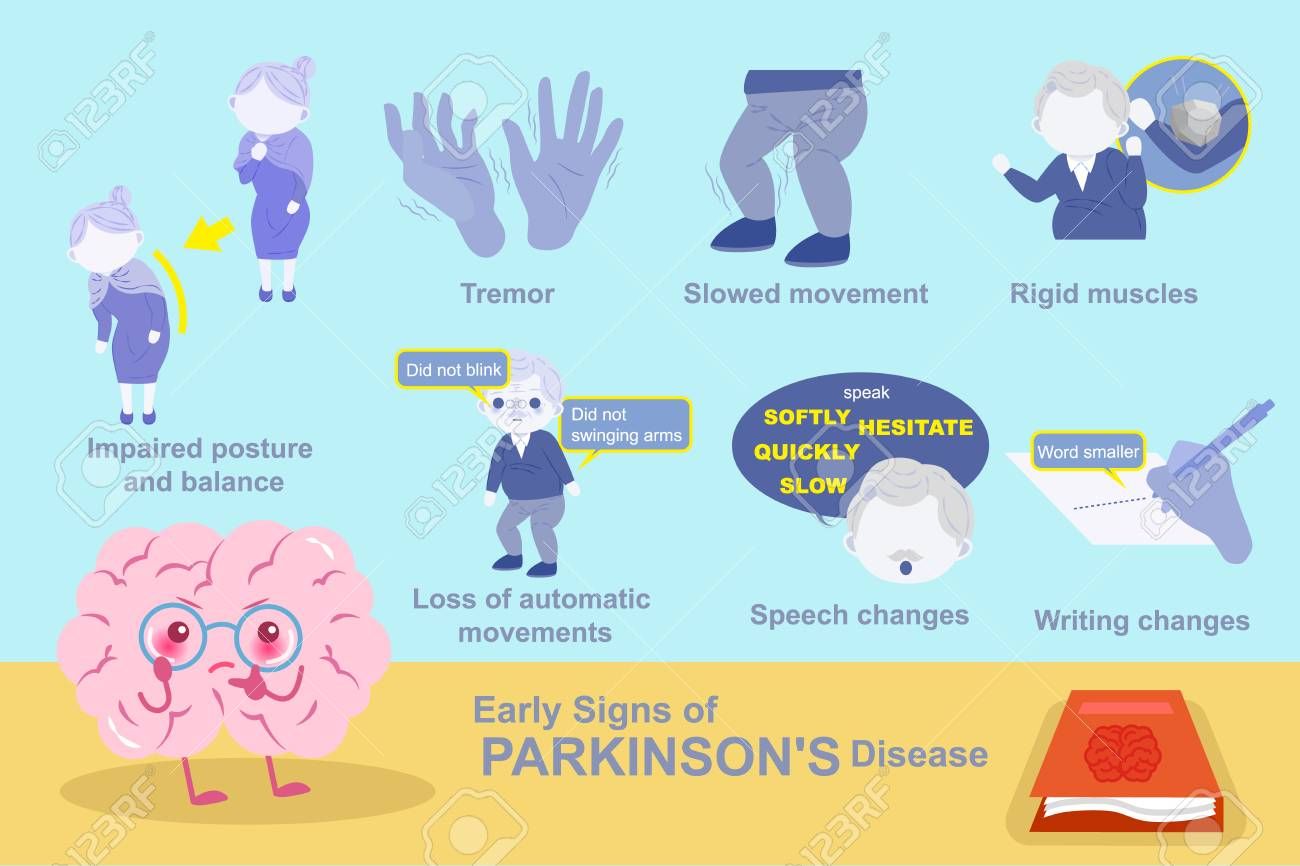 brain with early signs of parkinson disease on the blue ...