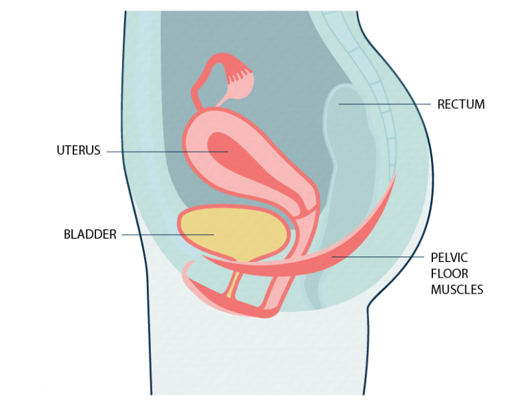 Can Urinary Incontinence Cause UTIs? Short answer