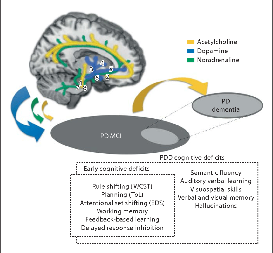 Cognitive Impairment in Parkinson