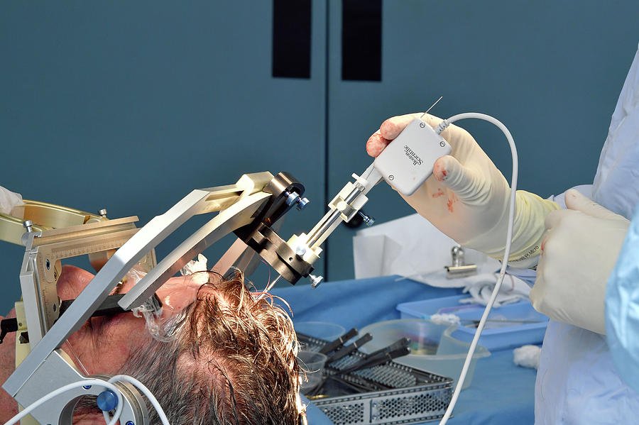 Deep Brain Stimulation Surgery Photograph by Dr P. Marazzi/science ...