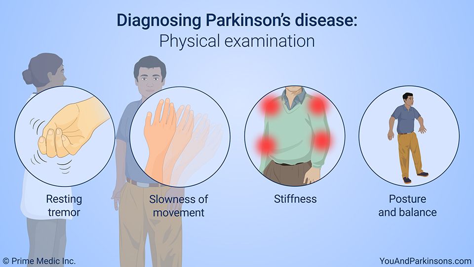 Diagnosing Parkinsons disease: Physical examination Your doctor will ...