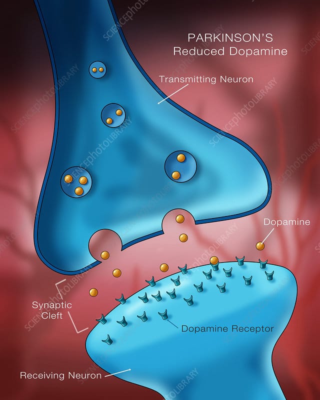 Dopamine in Parkinson