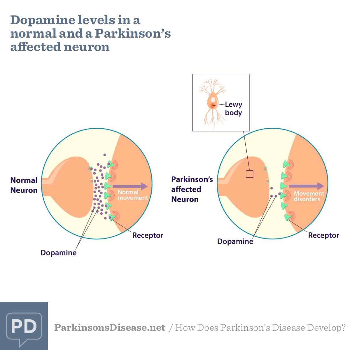 Dopamine Parkinson