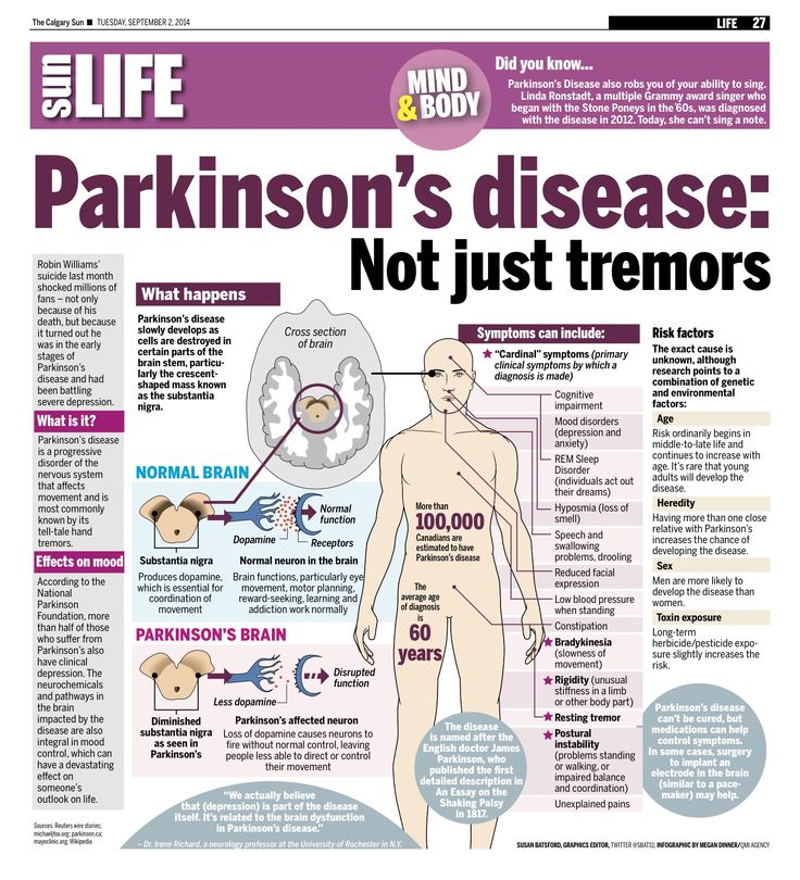 Early Parkinsons : Referral to a specialist