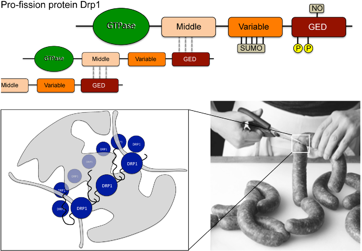 Figure 4 from Parkinson disease How Mitochondrial Dynamism ...