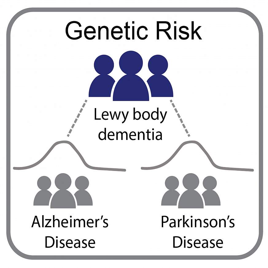 Genetic study of Lewy body dementia supports ties to ...
