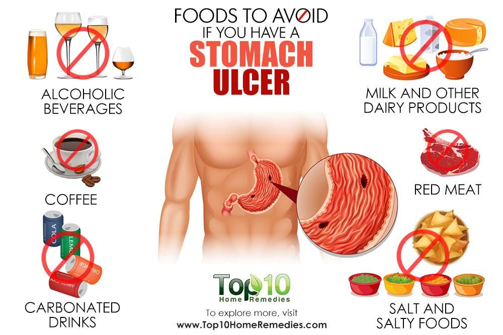 How do you find out if you have an ulcer