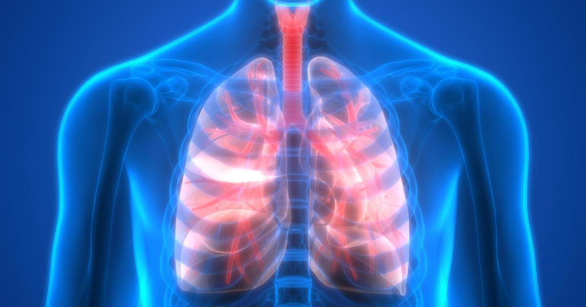 How Does Rheumatoid Arthritis Affect the Lungs?