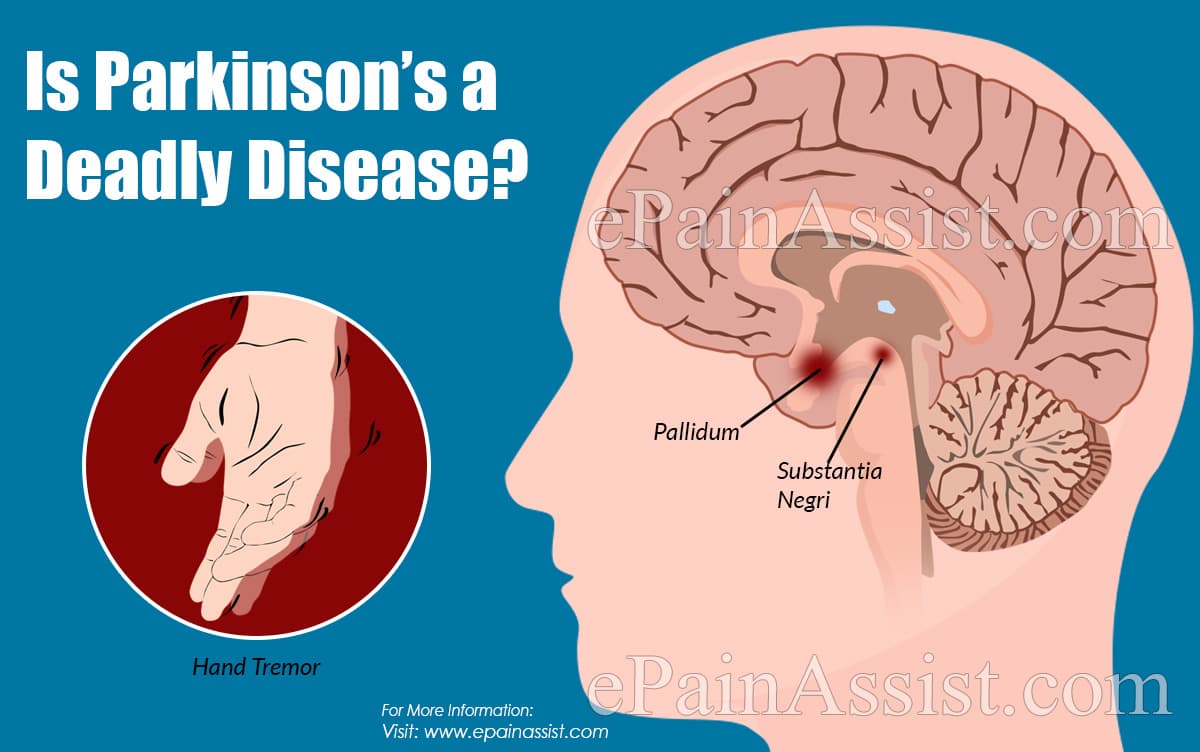 Is Parkinson’s a Deadly Disease?