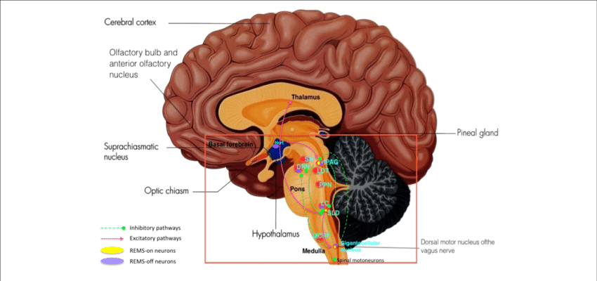key brain structures affected by lewy bodies lewy