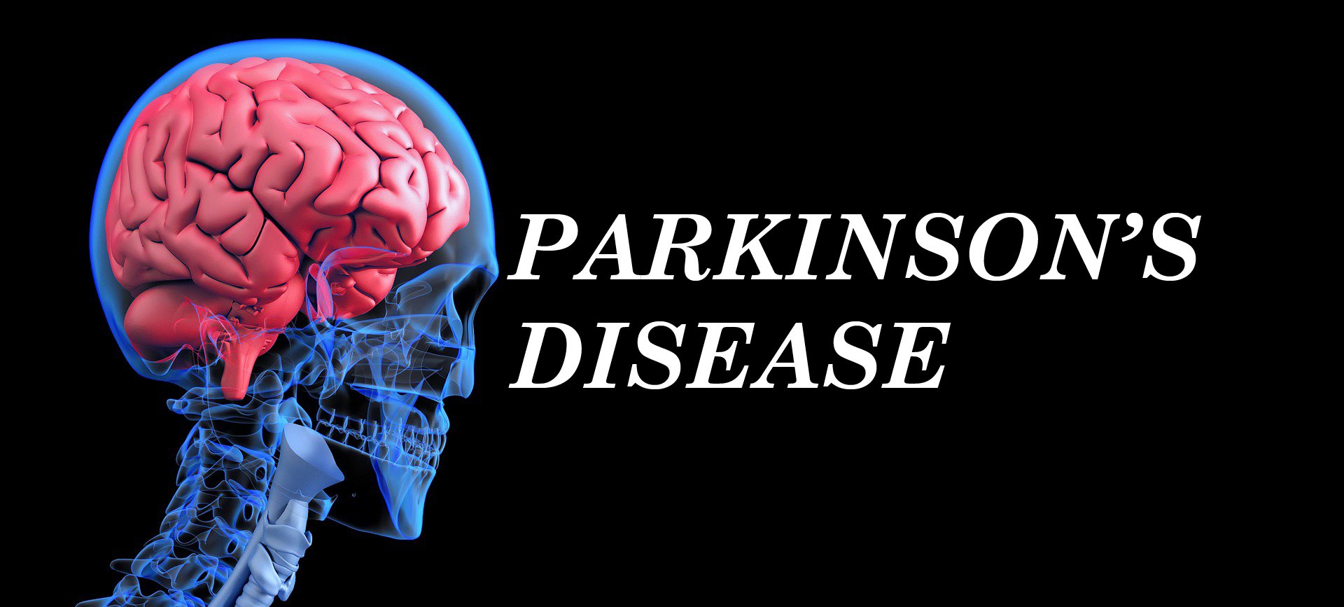 Living with Parkinsonâs Disease