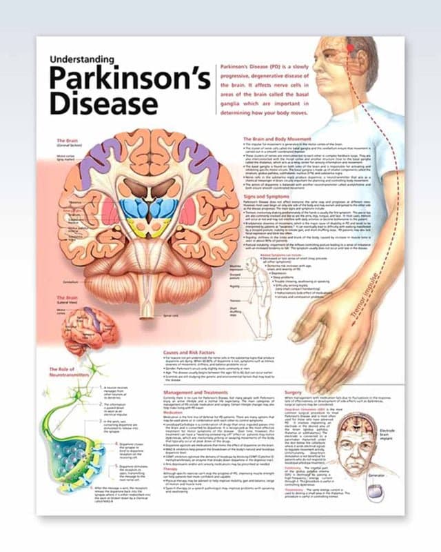 Neuro Exam For Parkinson