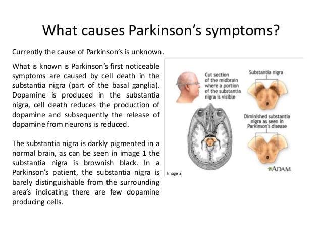 parkinson disease causes
