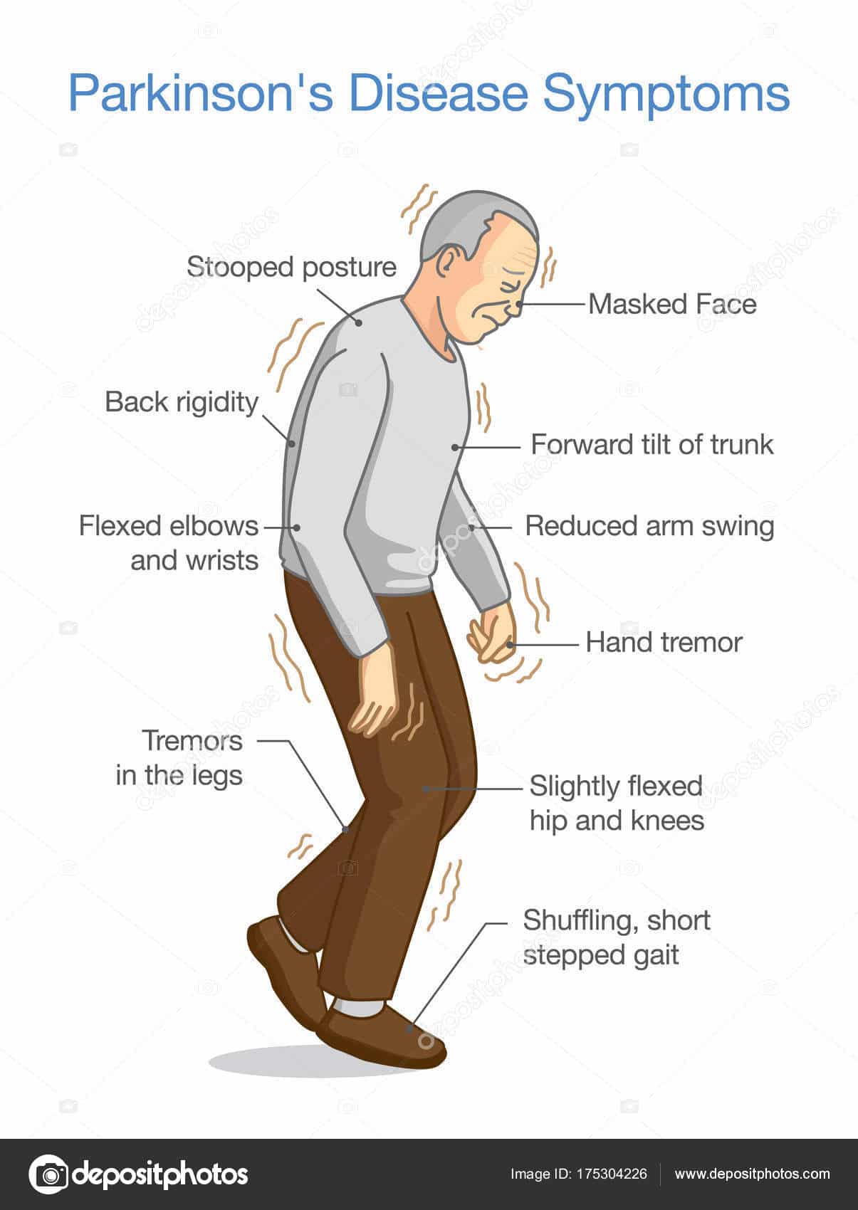 Parkinson Disease Symptoms Illustration Health Problem Elderly People ...