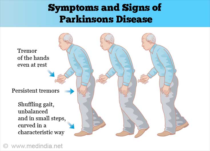 Parkinsonâ€™s Disease