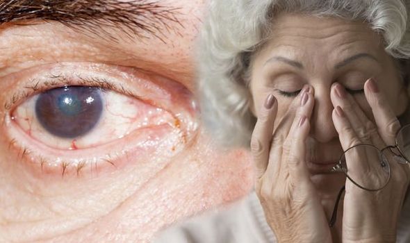 Parkinsons disease: Colour vision, dry eyes and double vision could be ...