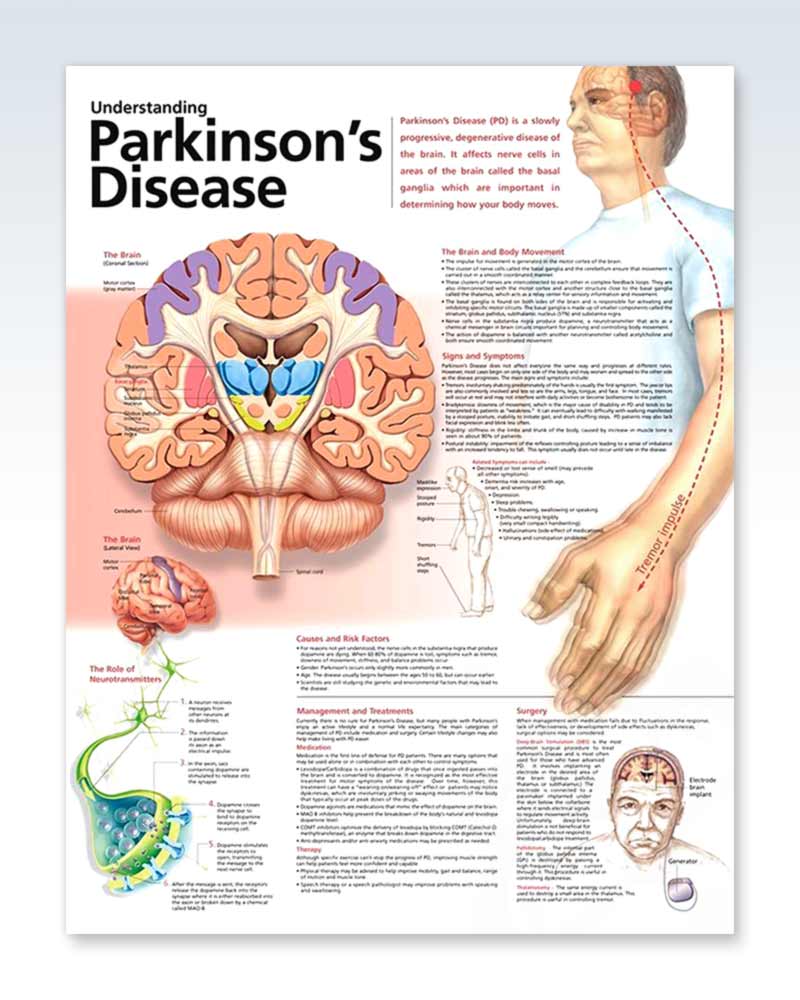Parkinsons Disease Exam