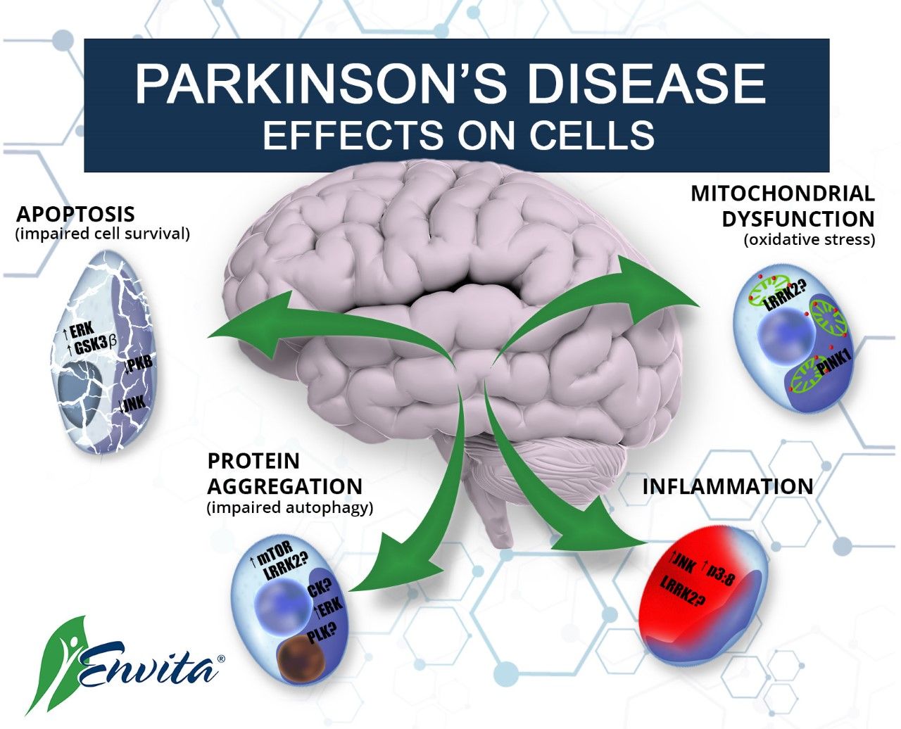 Parkinsons disease was first described in 1817 by James ...