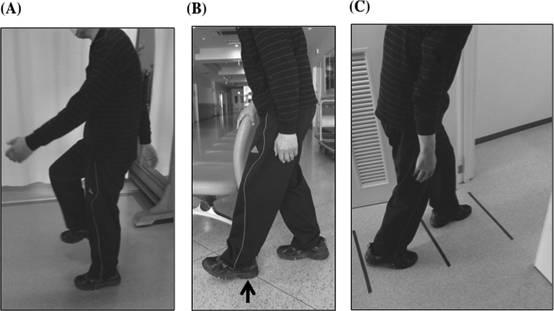 Practical approach to freezing of gait in Parkinson