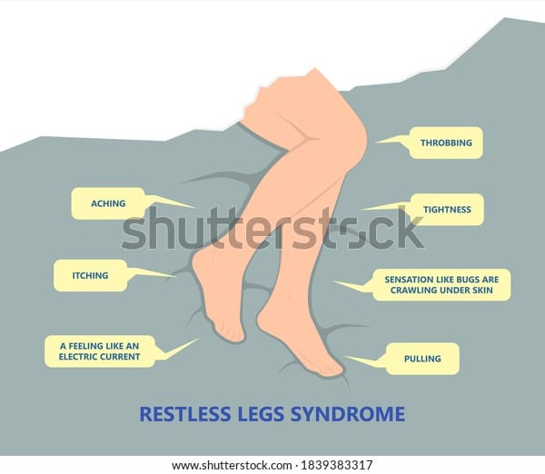 Restless Legs Syndrome Move Lying Down Stock Vector (Royalty Free ...