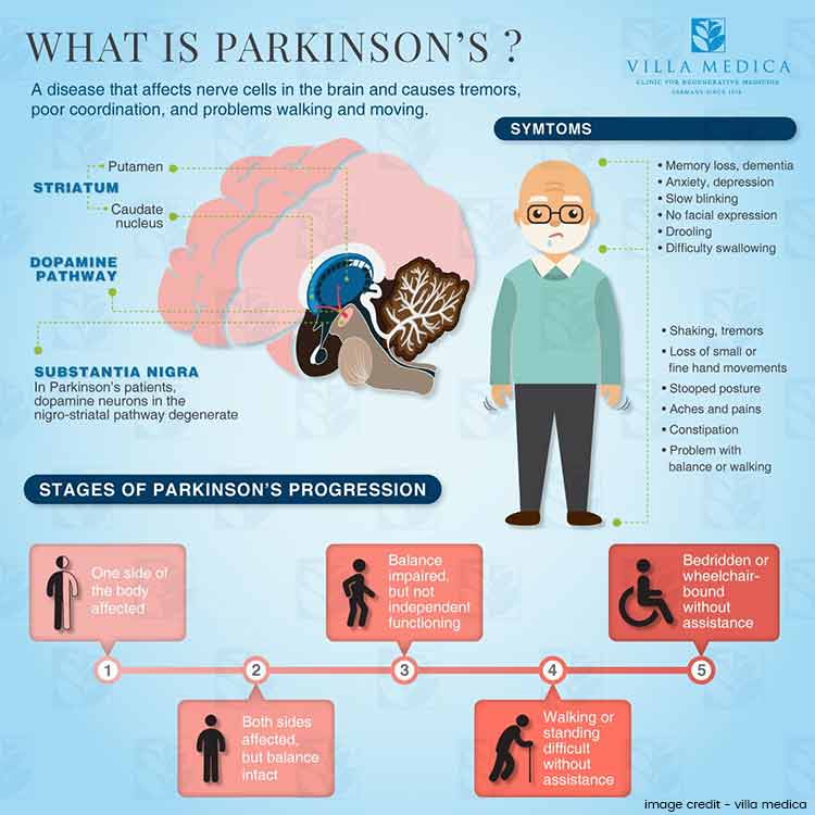 Study Reveals : Eating More Fish Could Prevent Parkinsons Disease