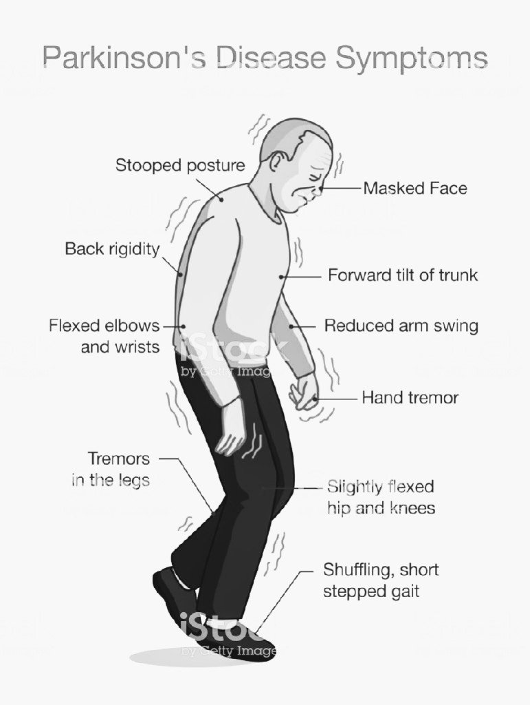 Symptoms of Parkinson
