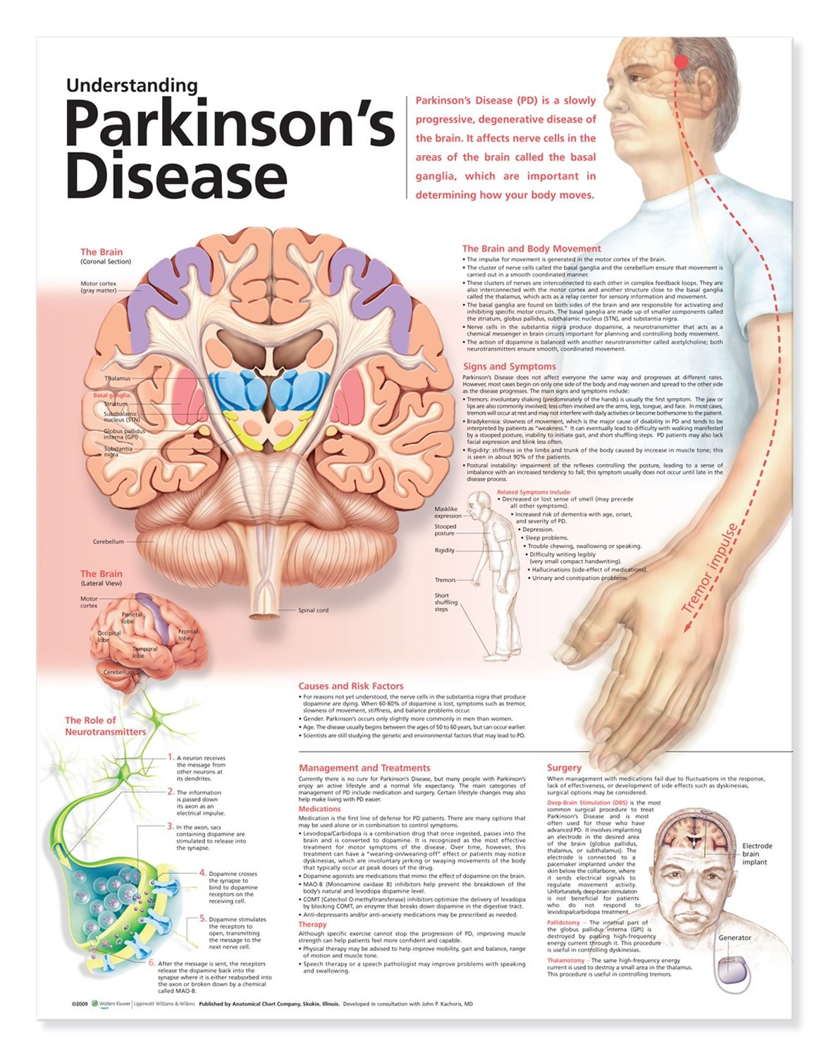 Understanding Parkinsons Disease Anatomical Chart, 2nd ...