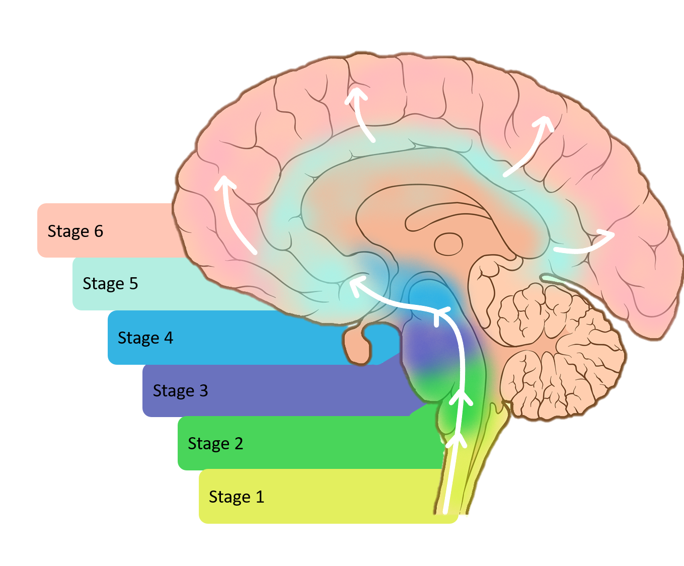 What brain areas are affected by Parkinsons?