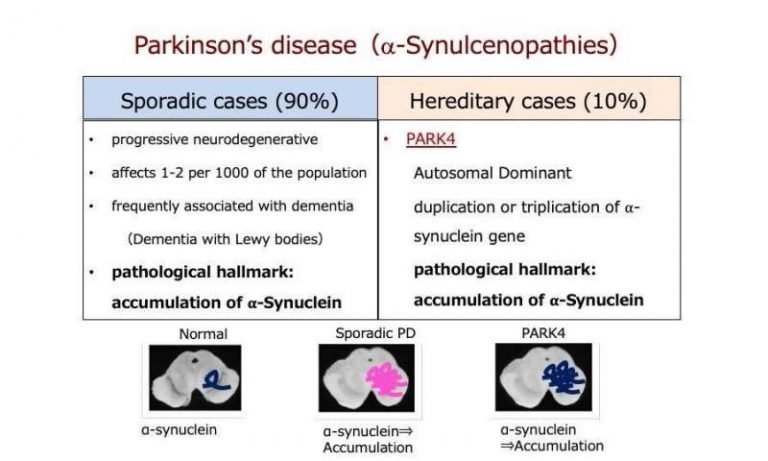 What Causes Death In Parkinson