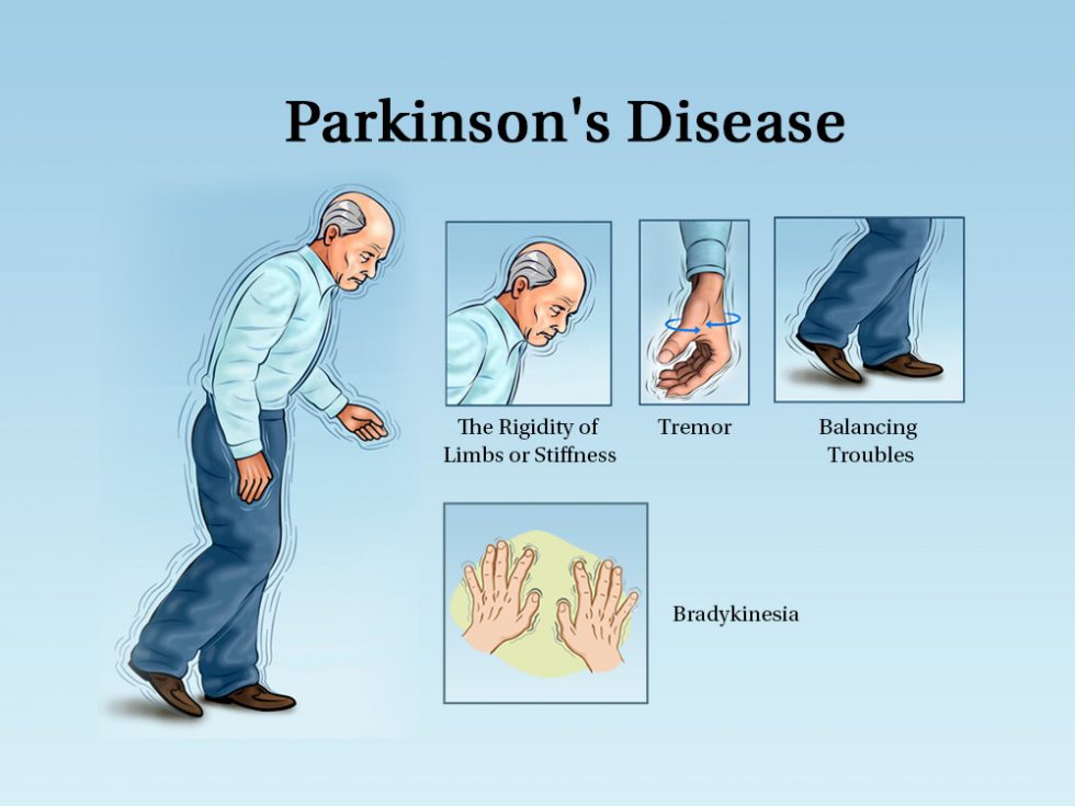 What is Parkinson’s? Let