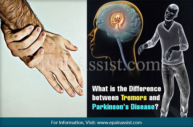 What is the Difference between Tremors and Parkinson